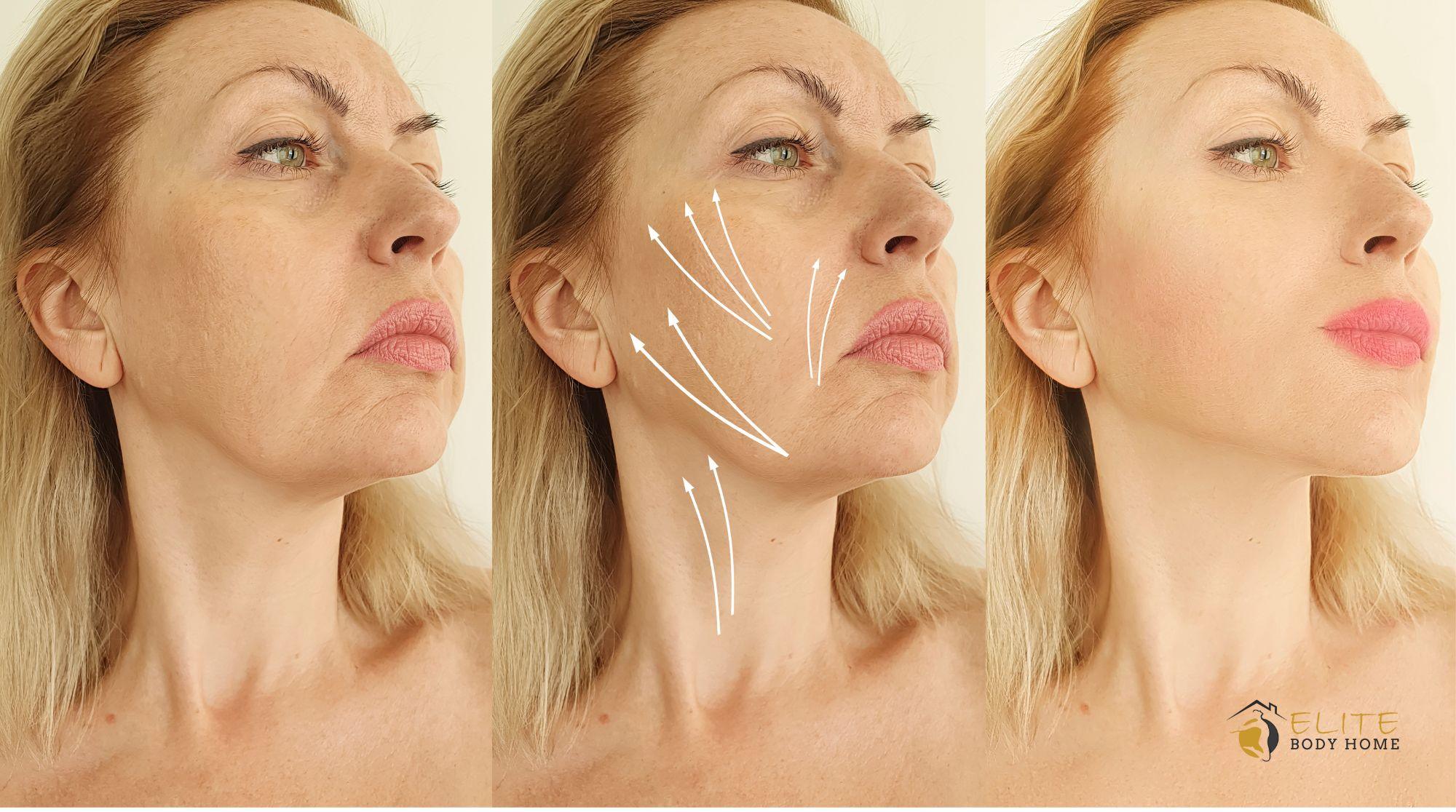 How Face Threading Redefines Anti-Aging Treatments?