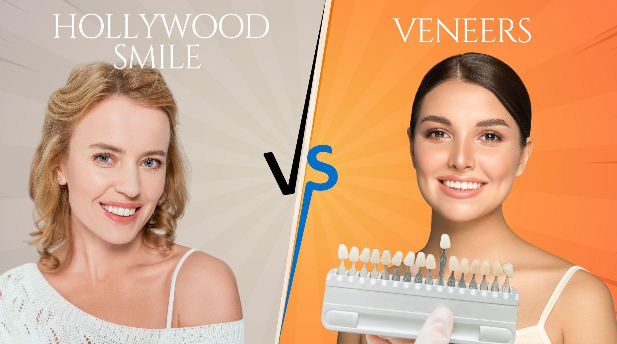 Hollywood Smile vs. Veneers: The Ultimate Guide to a Brighter, Radiant Smile