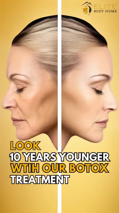 Botox
