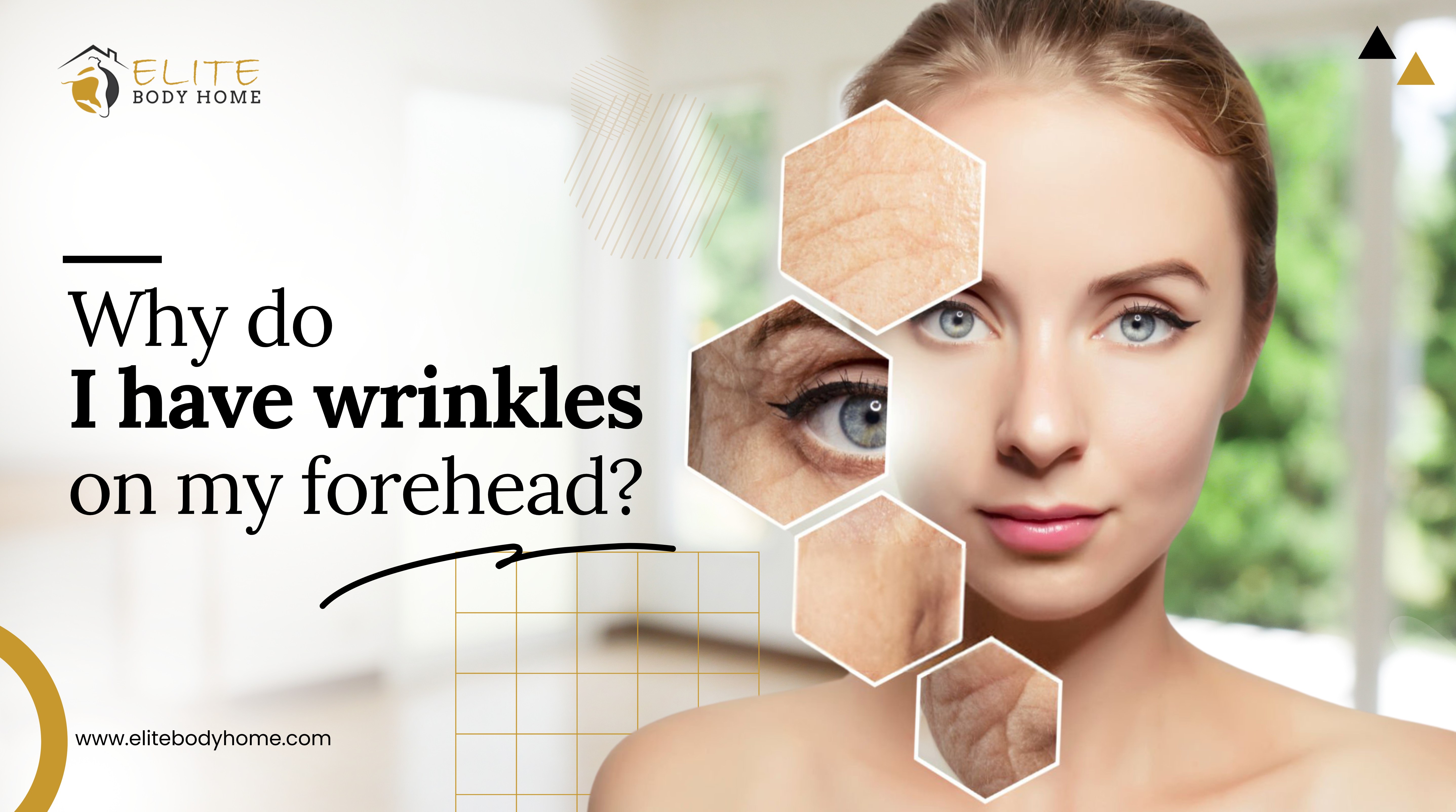Why Do I Have Wrinkles on My Forehead?