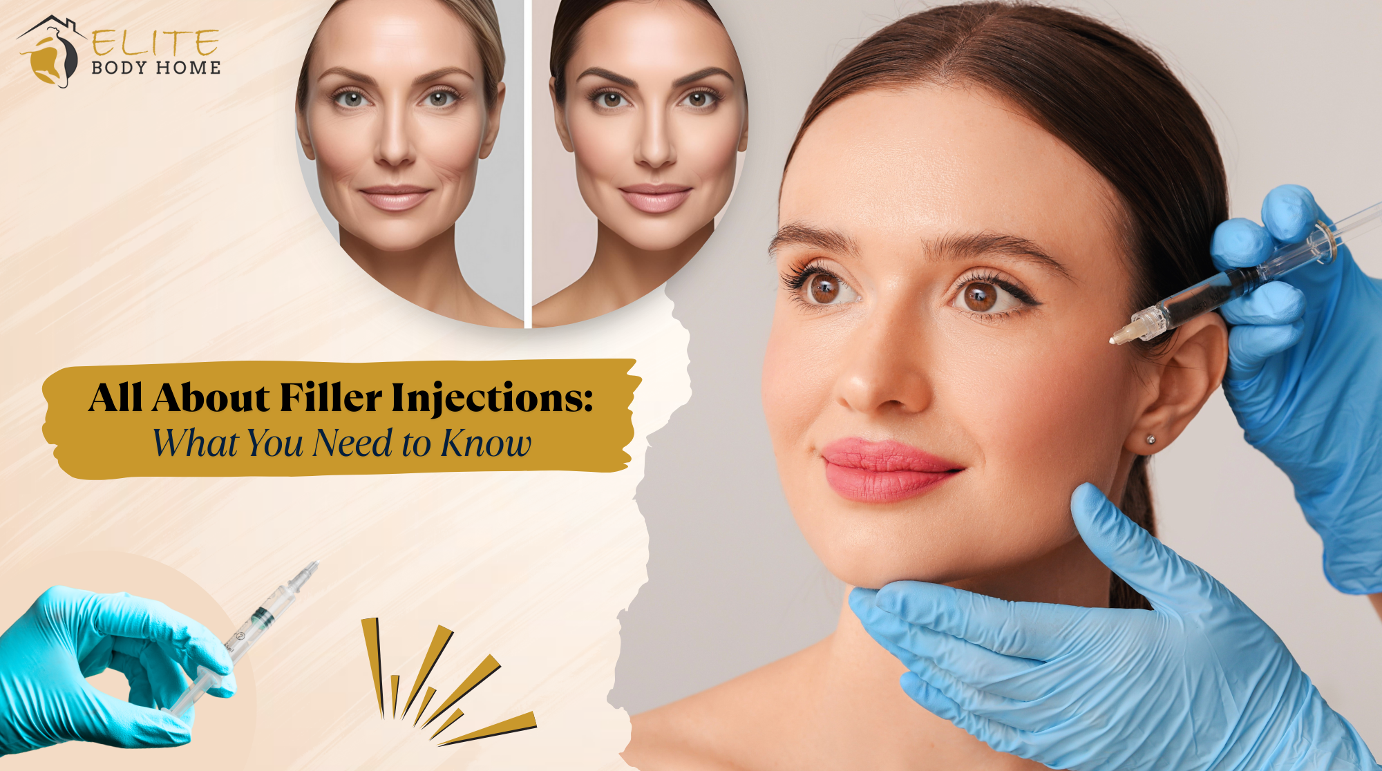 All You Need to Know About Filler Injections: What You Need to Know
