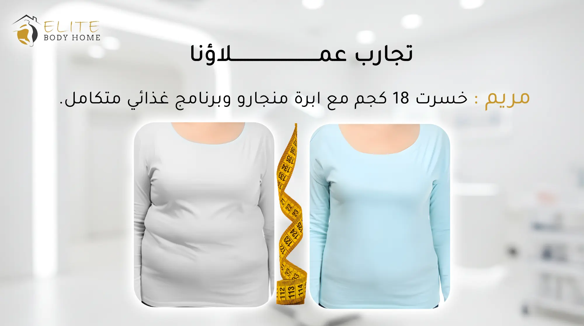 قصص نجاح التخسيس في دبي: من السمنة إلى الرشاقة