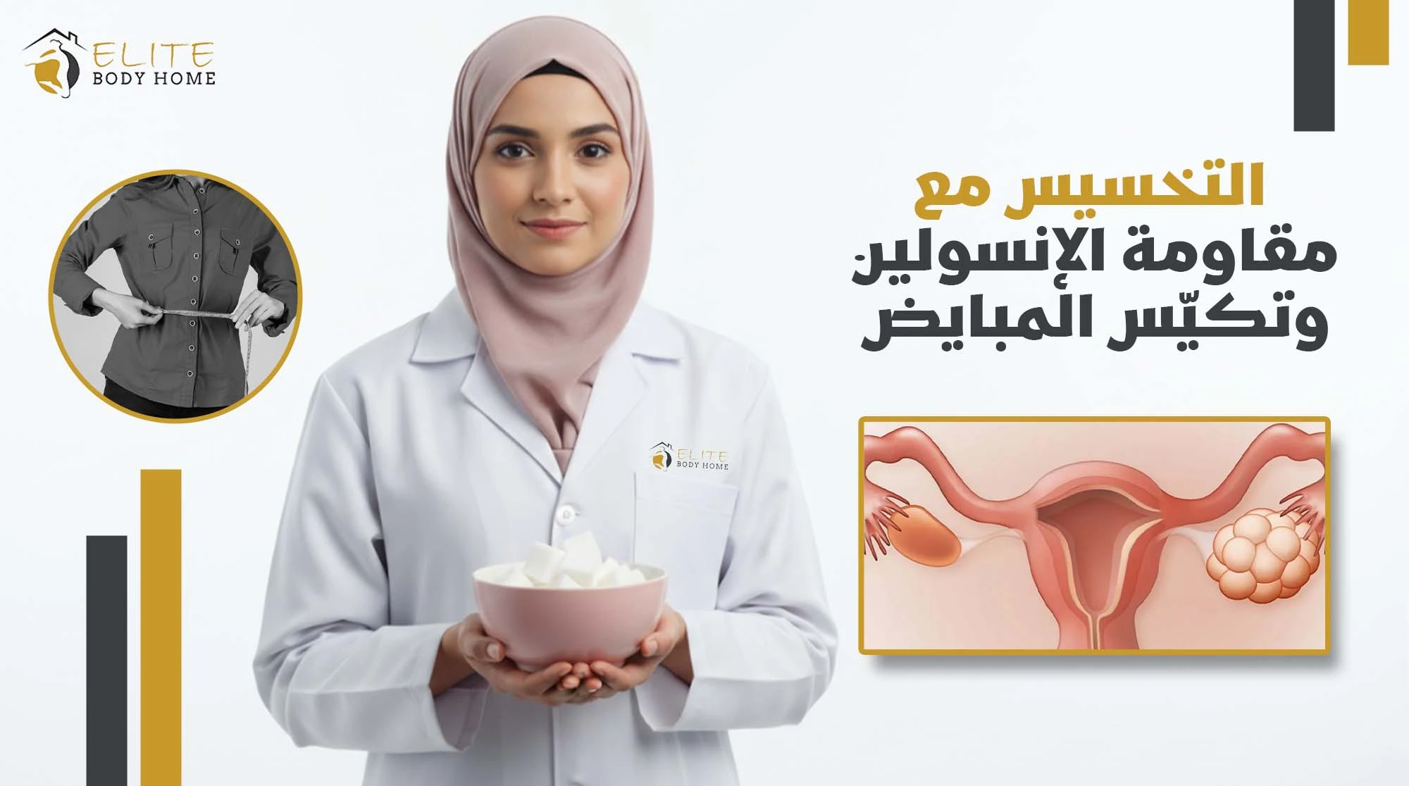 التخسيس مع مقاومة الإنسولين وتكيّس المبايض في دبي