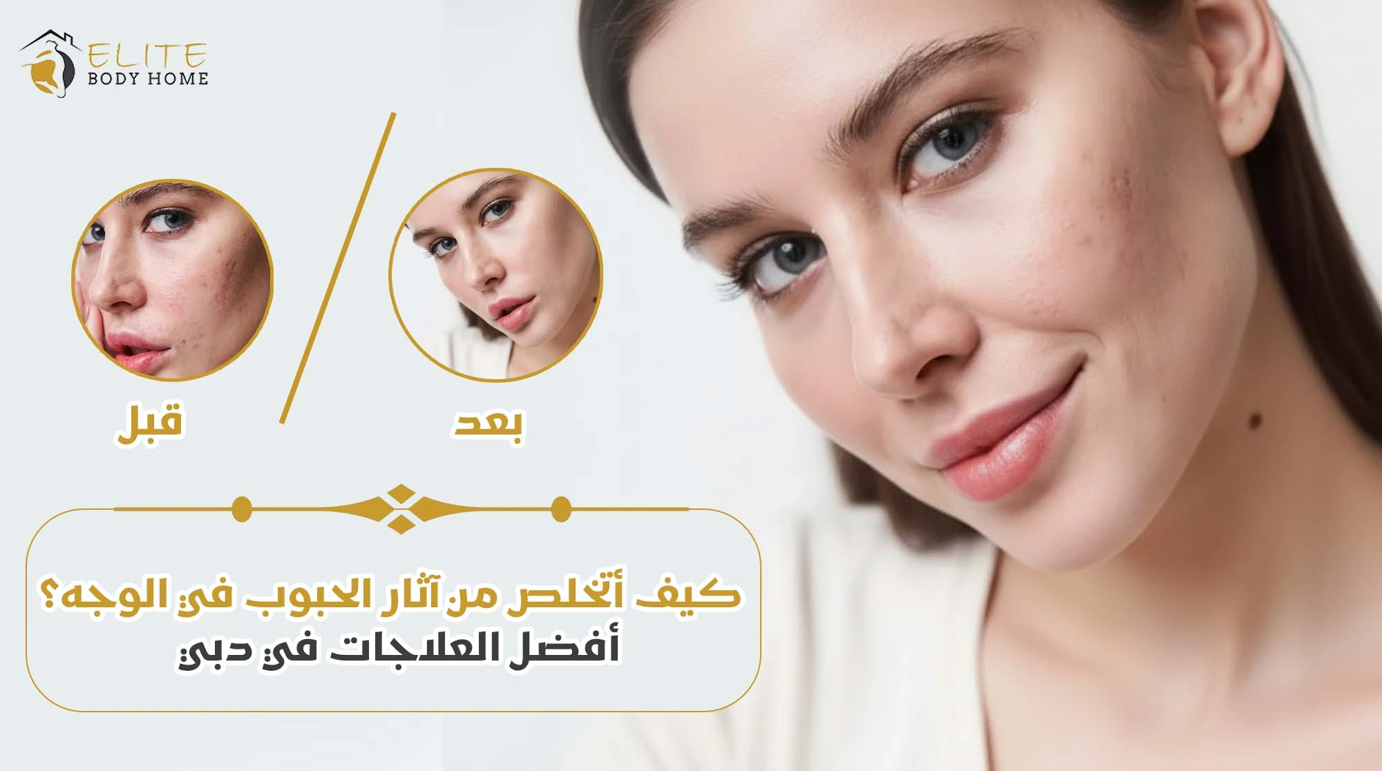كيف أتخلص من آثار الحبوب في الوجه؟ أفضل العلاجات في دبي