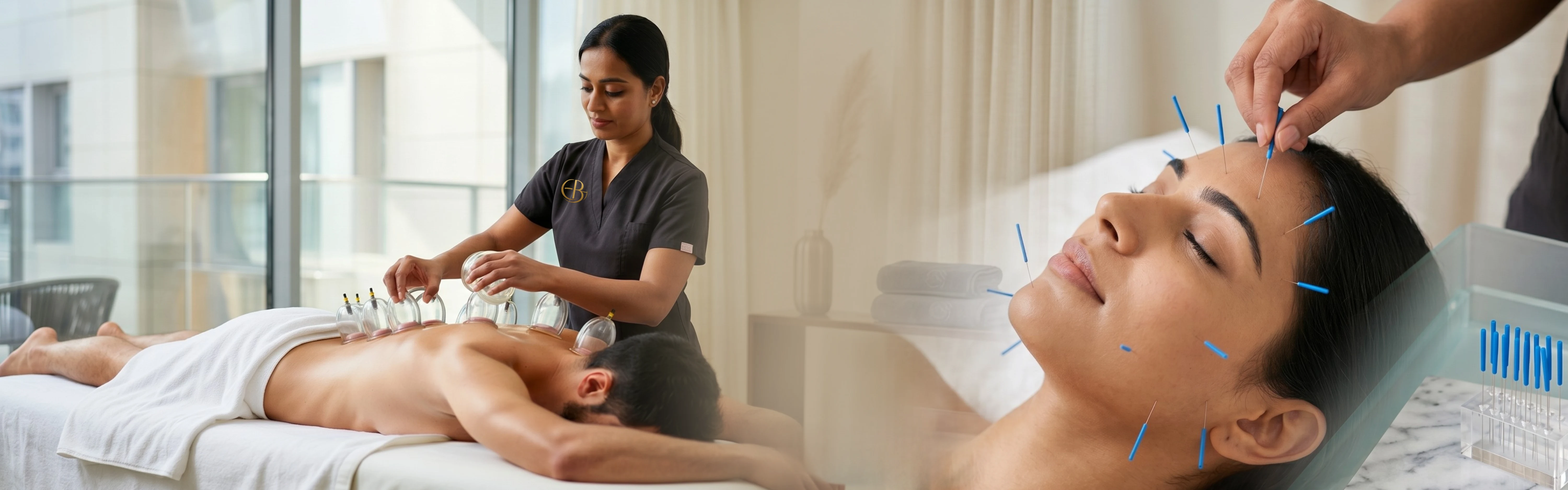 dry-needling-dry-cupping-in-dubai