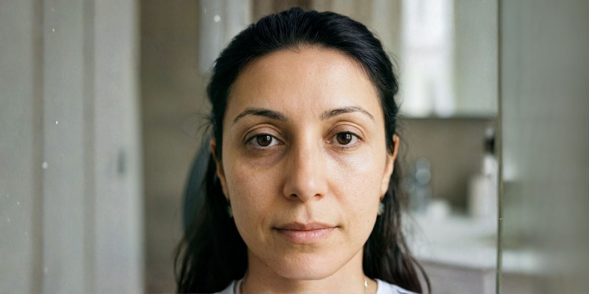 unser-eye-filler-Dark-Circle-Correction
