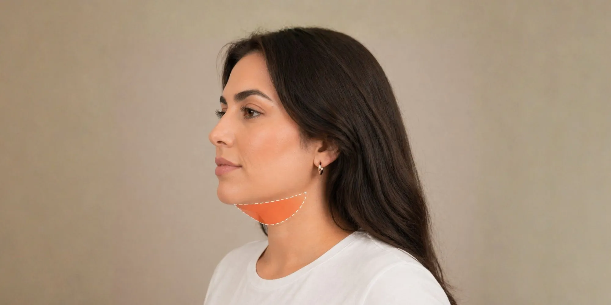 fat-freezing-double-chin