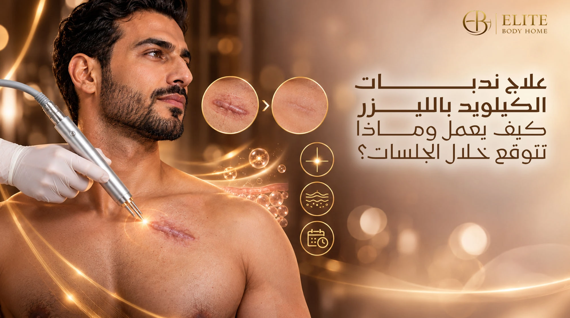 علاج ندبات الكيلويد بالليزر: كيف يعمل وماذا تتوقع خلال الجلسات؟